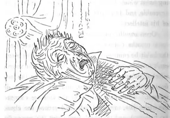 Mouth Breathing during sleep