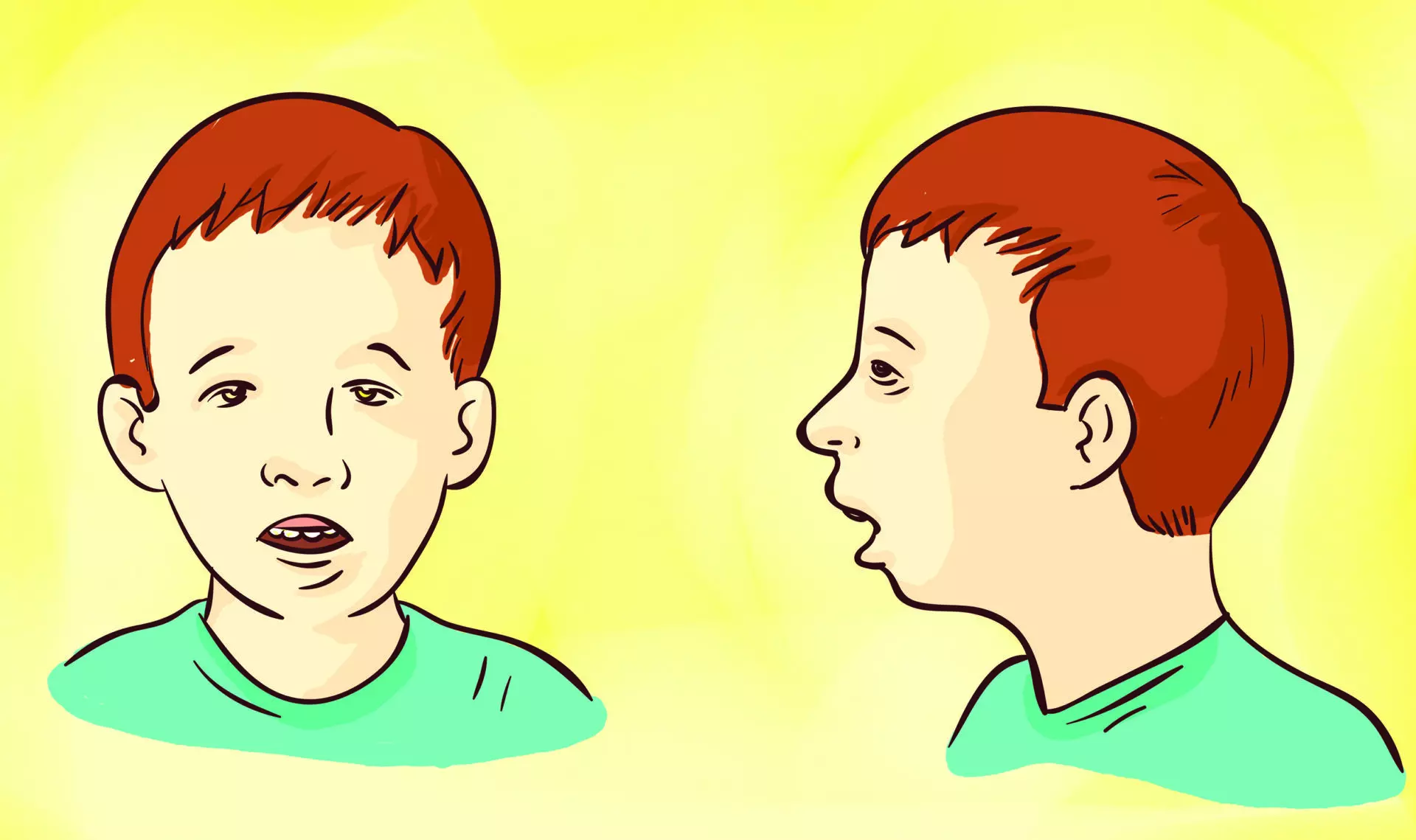 Front and side view of red-haired boy