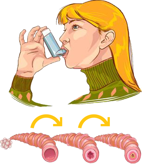 Natural Alternative